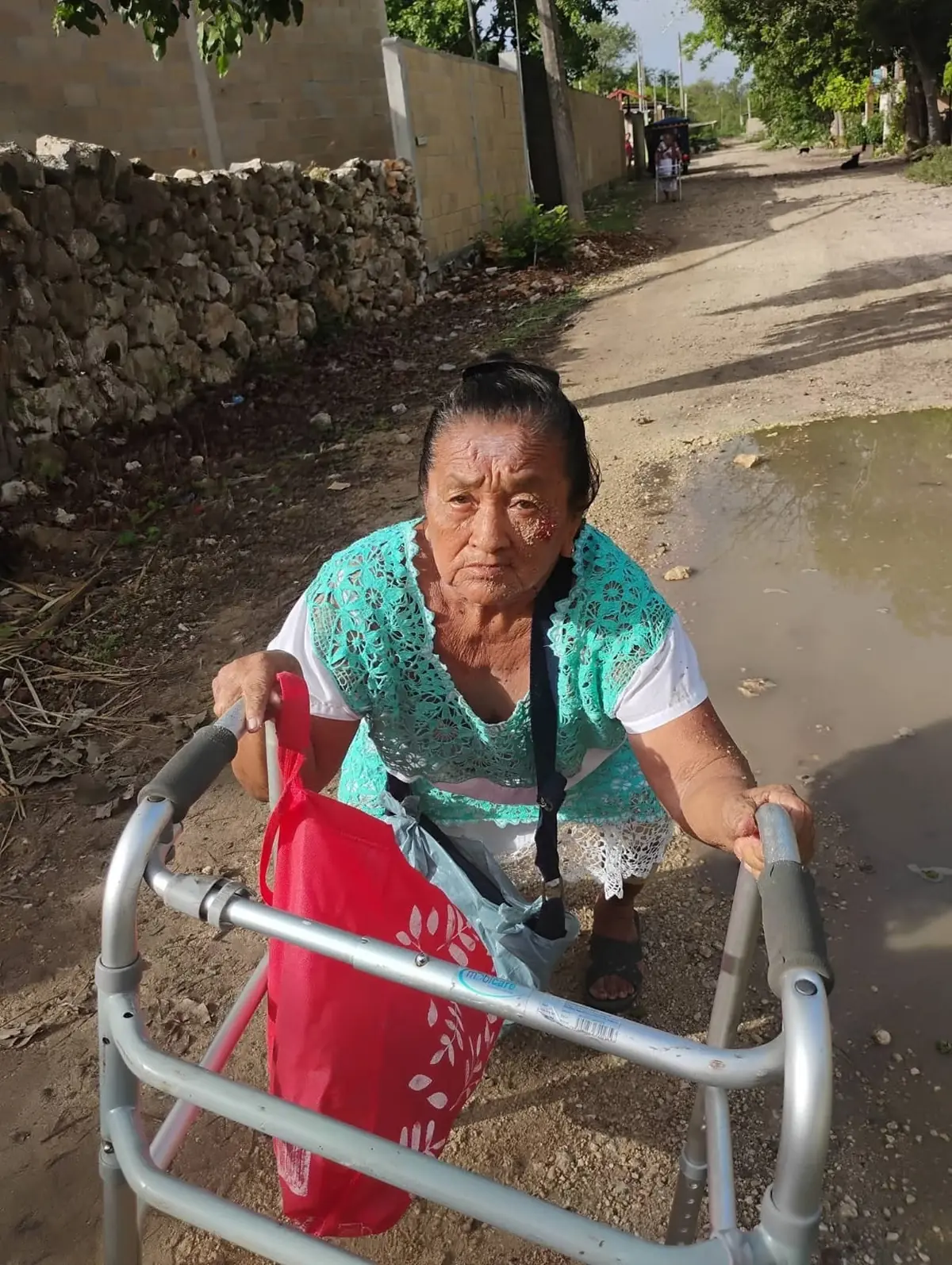 La comunidad de Hunucmá pide atención urgente para mejorar las calles y evitar futuros accidentes.