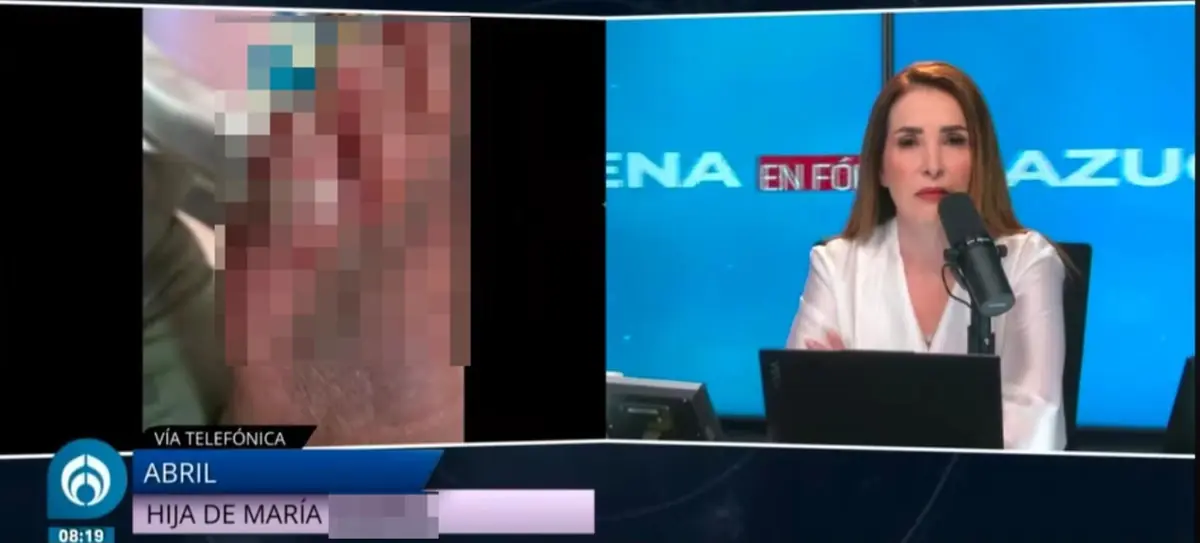 Se confirma intervención quirúrgica a paciente con pie diabético isquémico tras evaluación médica.