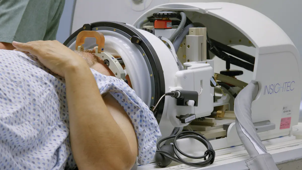 La tecnología Focused Ultrasound mejora la calidad de vida de pacientes sin cirugía.