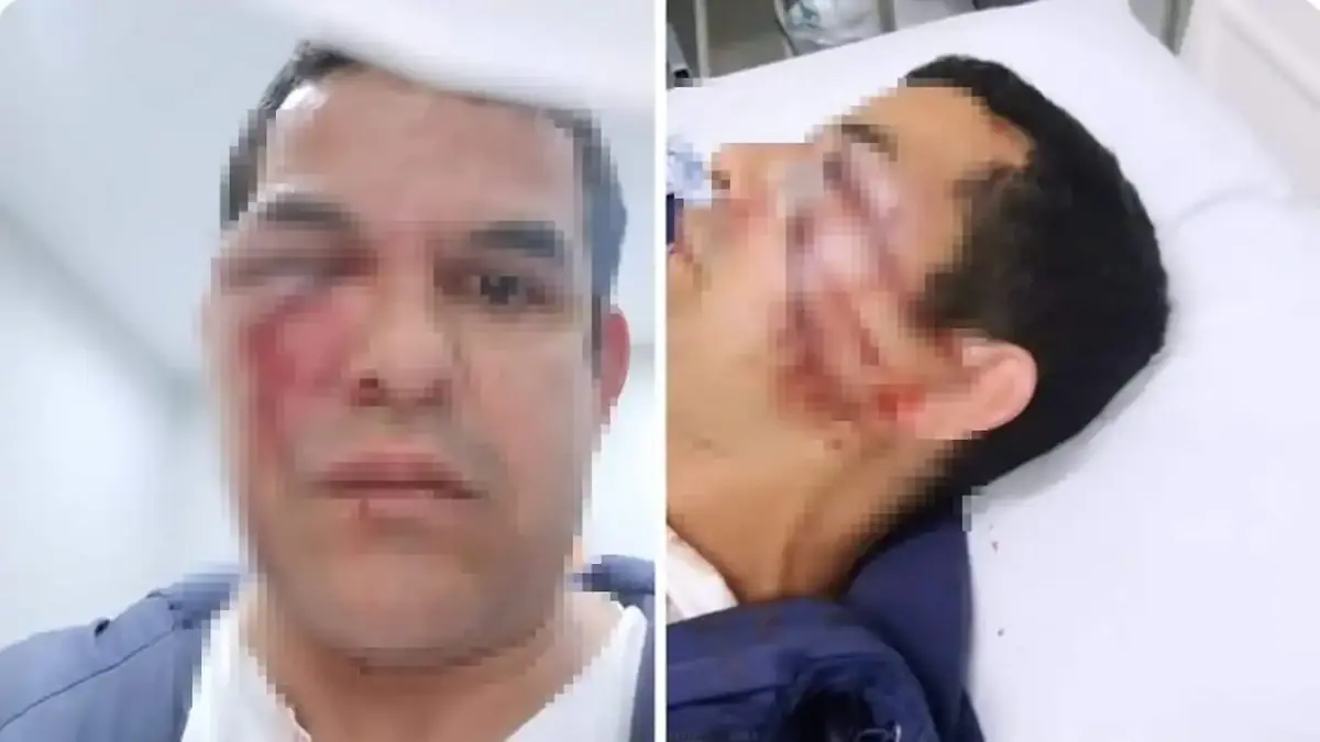 Un vendedor de 44 años sufrió agresiones y robo en un incidente motivado por homofobia en Praia das Palmeiras.