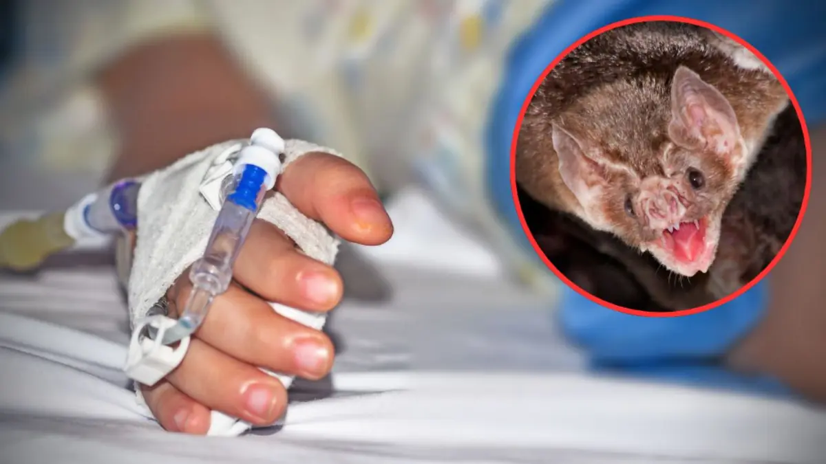 La tragedia resalta la importancia de la atención médica ante accidentes con animales.